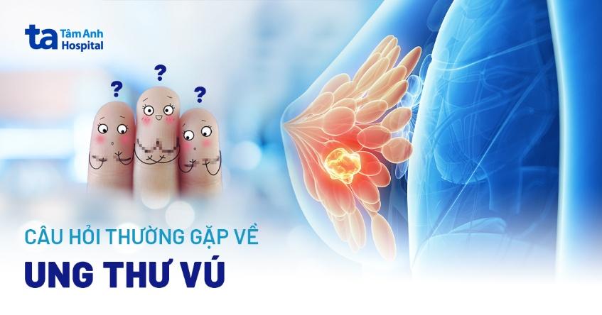 câu hỏi về ung thư vú