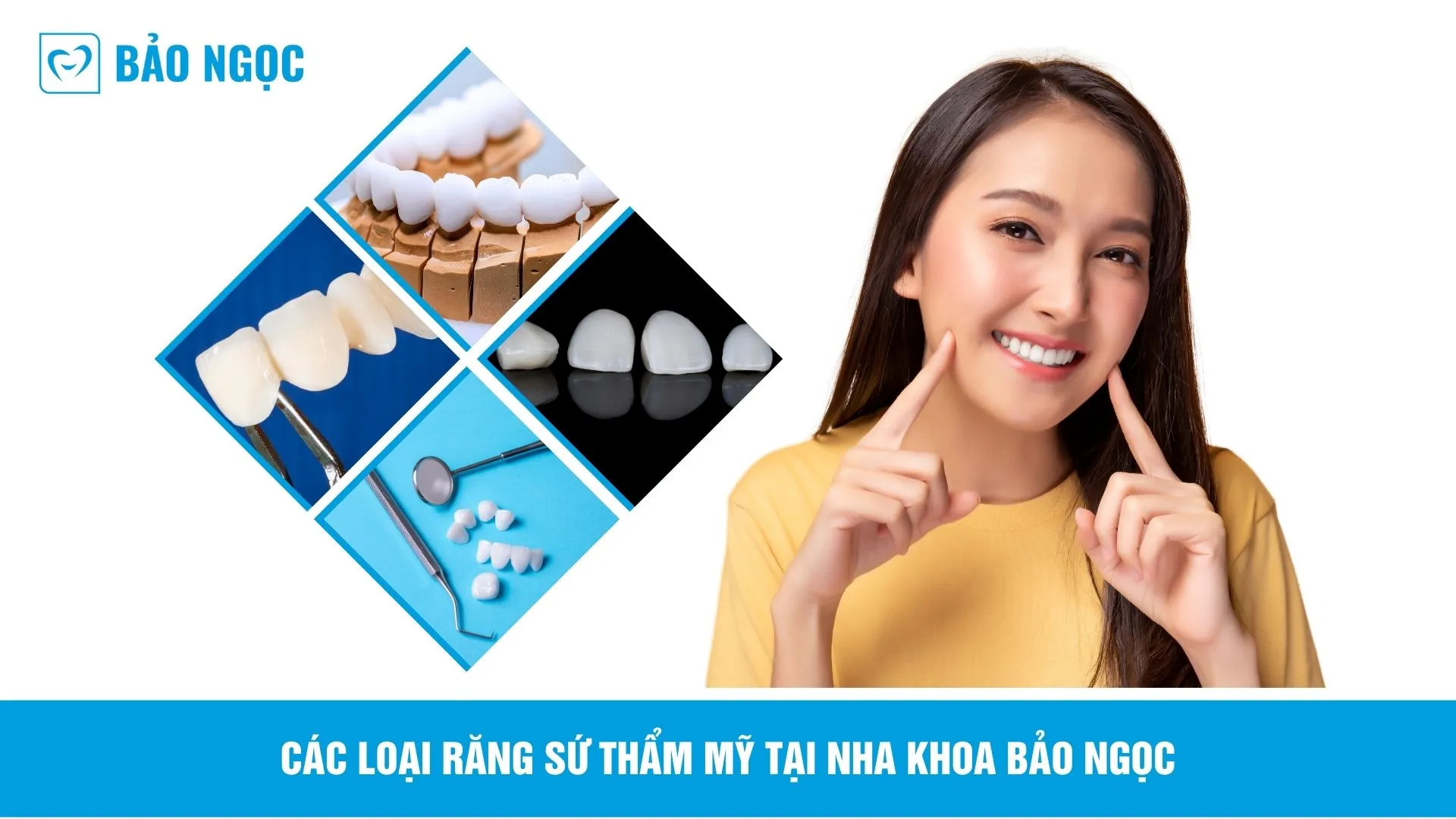 Bảng giá thẩm mỹ răng uy tín