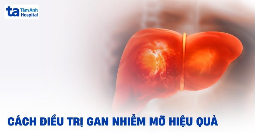 cách điều trị gan nhiễm mỡ